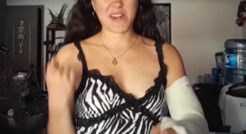 Princess with broken arm LAC