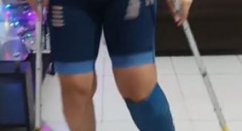 Blue leg cast at home