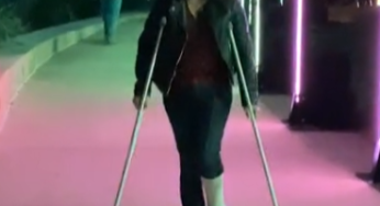 Short leg cast SLC