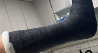 Fiber black cast SLC