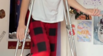 Nice lady with broken ankle and nice pedicure