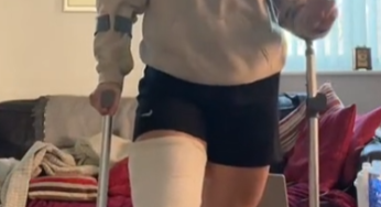 Long leg cast LLC