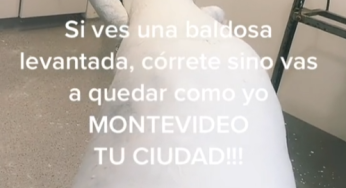 Fractura de perone.. Yeso hasta arriba y minimo un mes de reposo