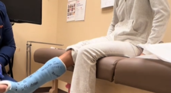 Blue leg cast , broken leg