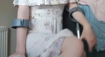 Short leg cast … cast video SLC