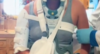 The things we take for granted – Broken back , leg and arm