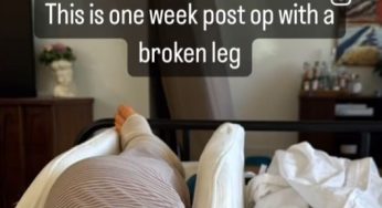 It’s been one week since my emergency surgery for a broken leg
