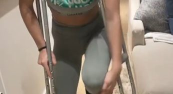 Me with my broken leg on st. patrick’s last year