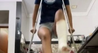 Jumping with plaster leg cast SLC