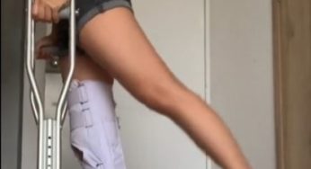 Woman with broken knee at home