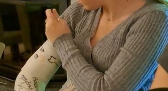 Laura with fiber perfect arm cast LAC