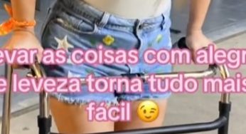 Brazilian woman with plaster leg cast