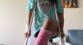 i just can’t believe it’s been two months since i fractured my ankle