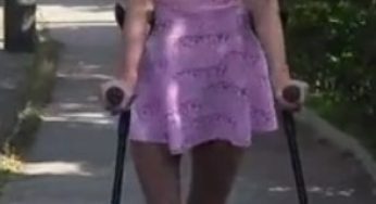 Blue leg cast SLC
