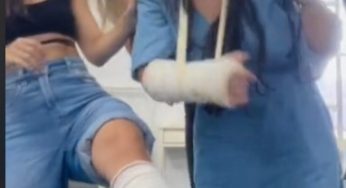 Class of getting plaster cast SLC , LAC , SAC