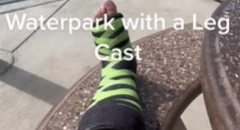 Lunch with broken leg SLC
