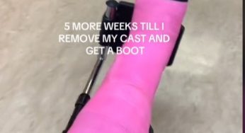 YOUR GIRL FINALLY UPGRADED TO A BOOT AND CAN START WEIGHT BEARIN