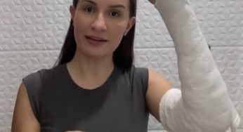 Tentativa de skincare com o gesso