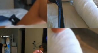 Plaster long leg cast LLC in all directions