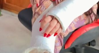 Perfect red manicure and pedicure with plaster cast