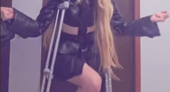 Singer Karol Sevilla with broken leg SLC cast