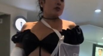 Colombian woman with dual broken arm