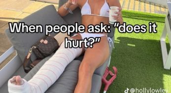 Broken Tibia and Fibula… 2 weeks post op, 3 weeks since the accident