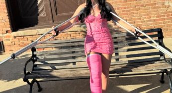 Perfect pink long leg cast LLC