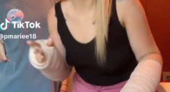 Both broken arms and leg