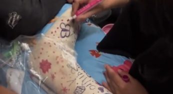New leg cast SLC