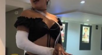 Latin woman with plaster arm cast LAC