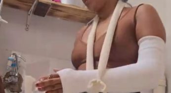 Cooking with plaster arm cast LAC