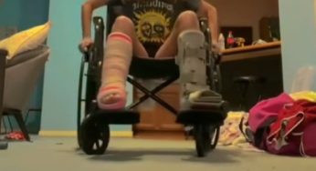 Breaking both ankles is not for the weak
